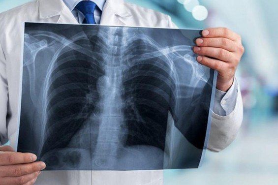 ��������� ��-�� COVID-19 �������� ����� �������� ������� �������������� ������������