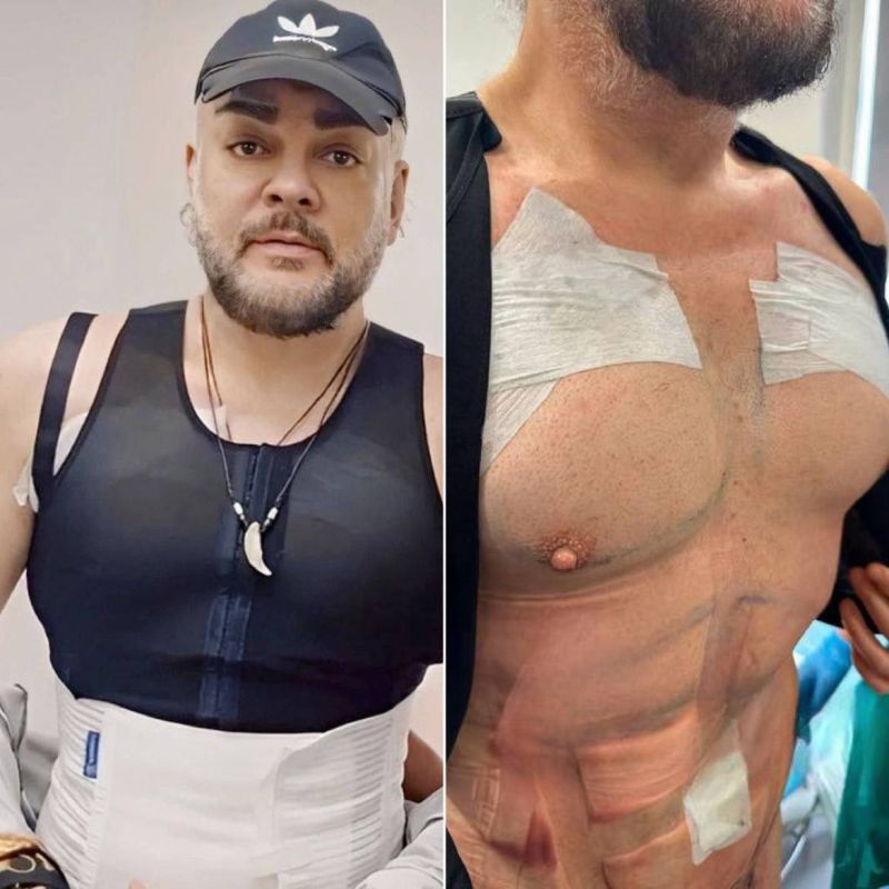 �������� ���������� ��� ��������� ��������������