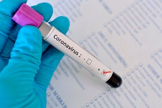 ������ COVID-19. ������ �� 27.03.2023 �. �� ���