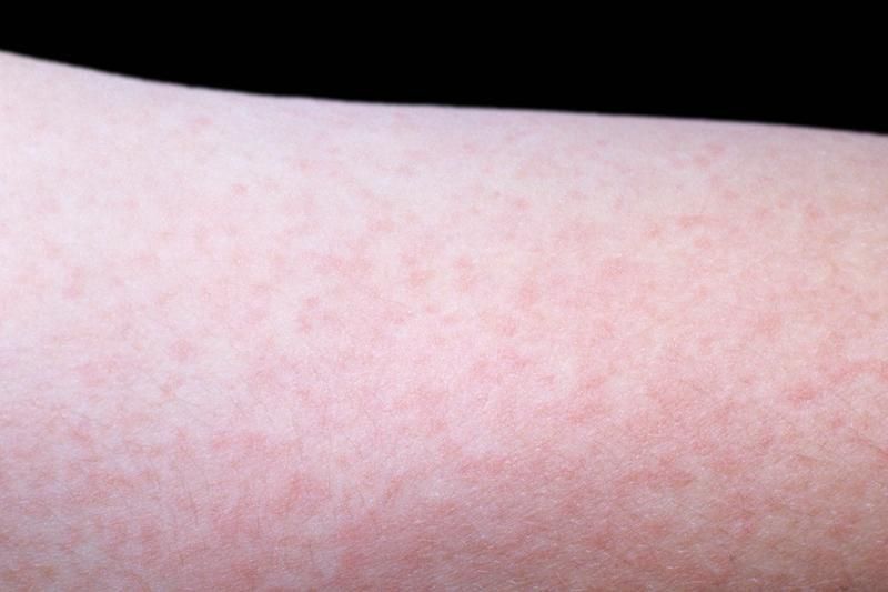 ������������ ��������������� ������� �������� � ������ �������� ����, ���������������� ����� ���� ����� ��������� ���� ������� � 29 ������