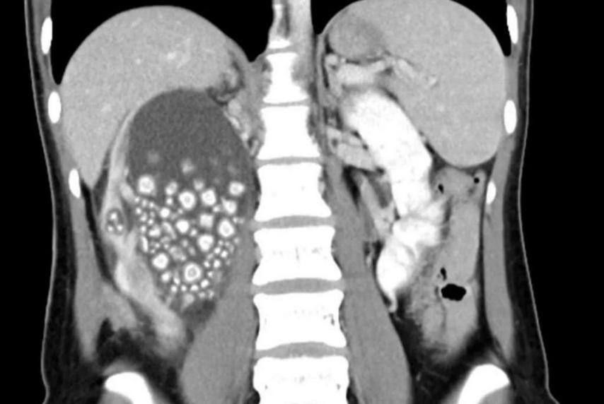 � ������� ������� ������ 300 ������ �� �����, ������ ��� ��� ���� ������ ������� ������� ������ ����