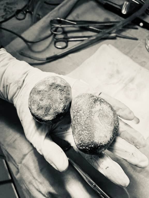 � ���������� ������������ ����� ������� �� �������� ������ ��������� �����-������� �������� � ������