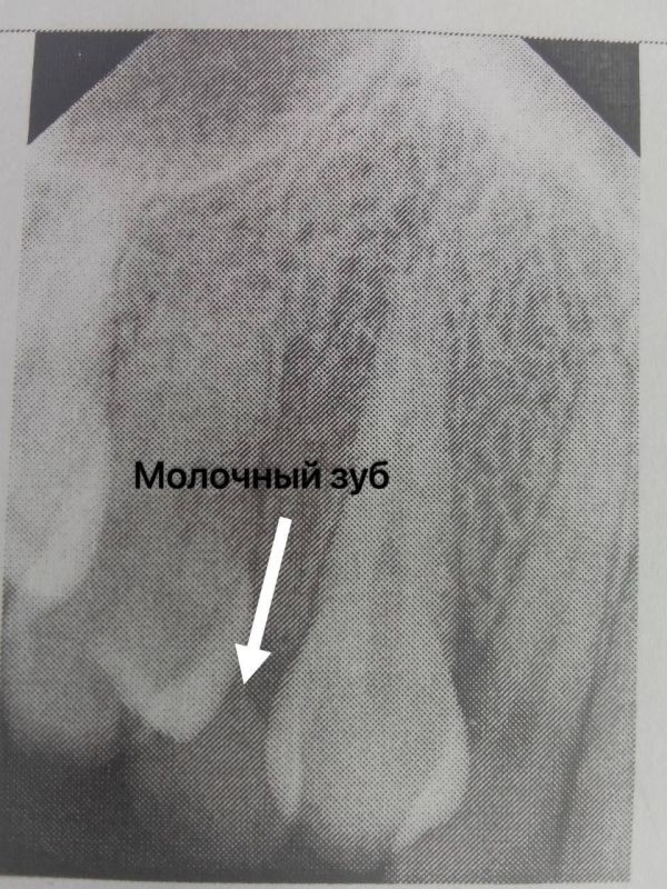 � ����������� ����������� ������� 24-������ ������� �������� ����, ��� �������� ������� ��������� ��� �������� �����