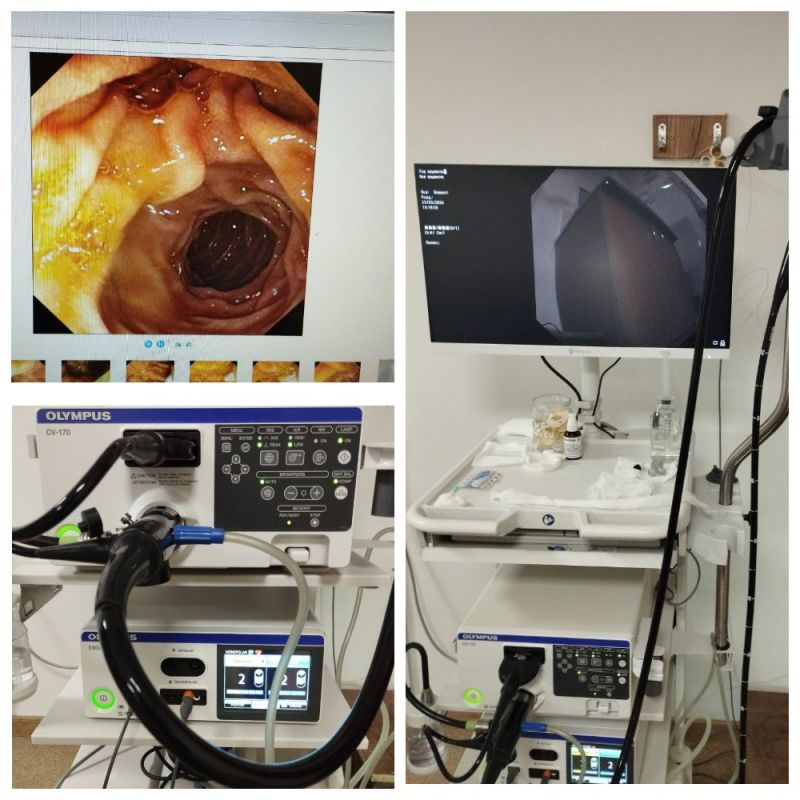 ������������ � ���. �������������������� ������� Olympus ��� ������������ ���������-��������� ������ ��������� � ��������������� ����������� ��������