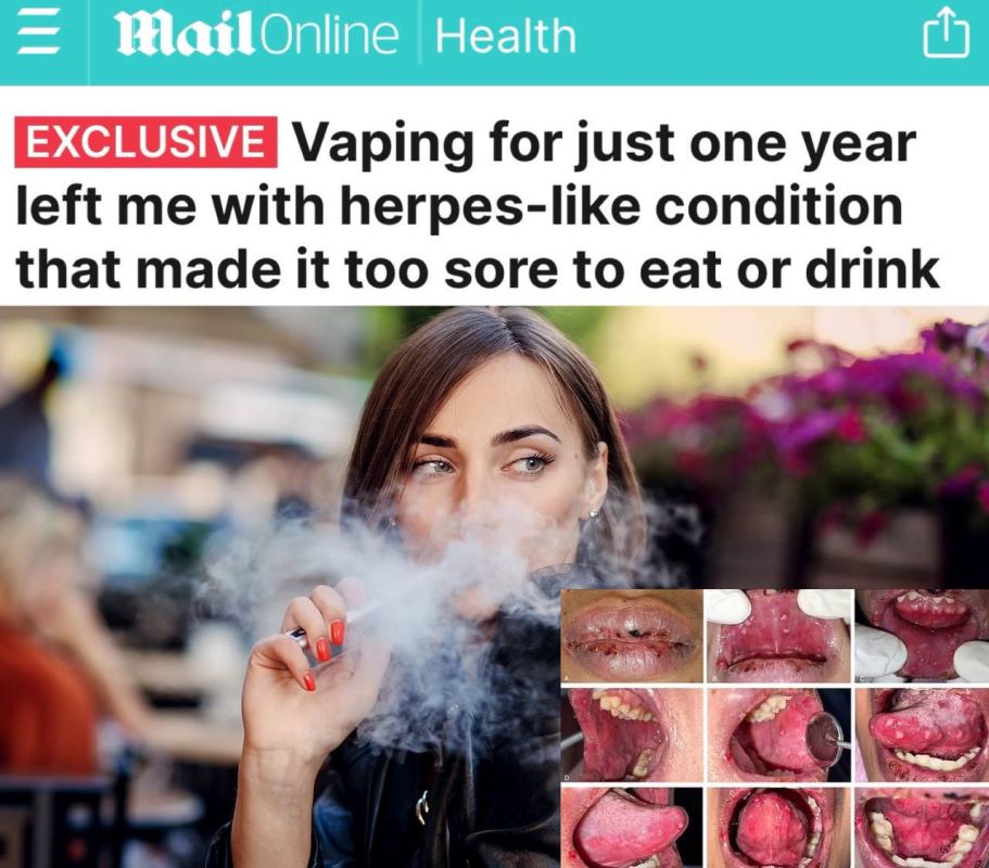 � 22-������ ������� �� ��� ������� ����� �� ��� ������������ �������� ����, ��-�� ������� ��� �� ����� ���� ������ ����