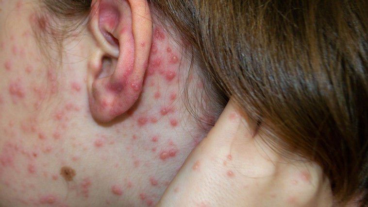 � ��������� ������������� ����� ������� ���� � ����������� �����