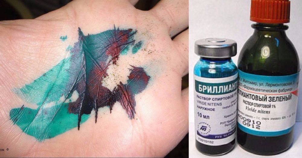 Зелёная месть. Житель Григориопольского района задумал наказать обидчиков-односельчан по-особенному. Давних недоброжелателей 38-летний мужчина решил заклеймить