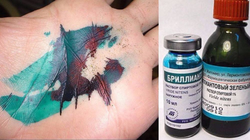 Креативная месть: Житель Приднестровья искупал обидчиков в зеленке