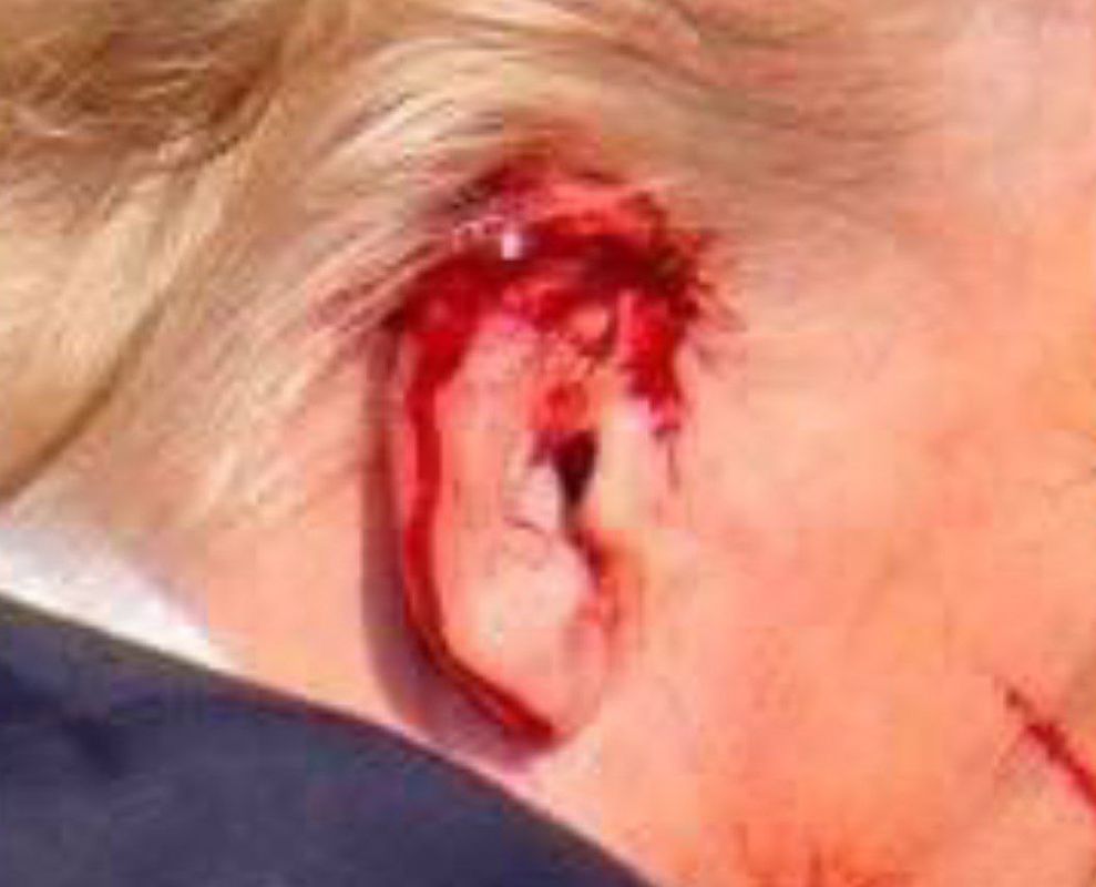 ���� ���!