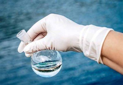 По кишечным инфекциям эпидситуация в республике остается неблагополучной, отмечает Минздрав