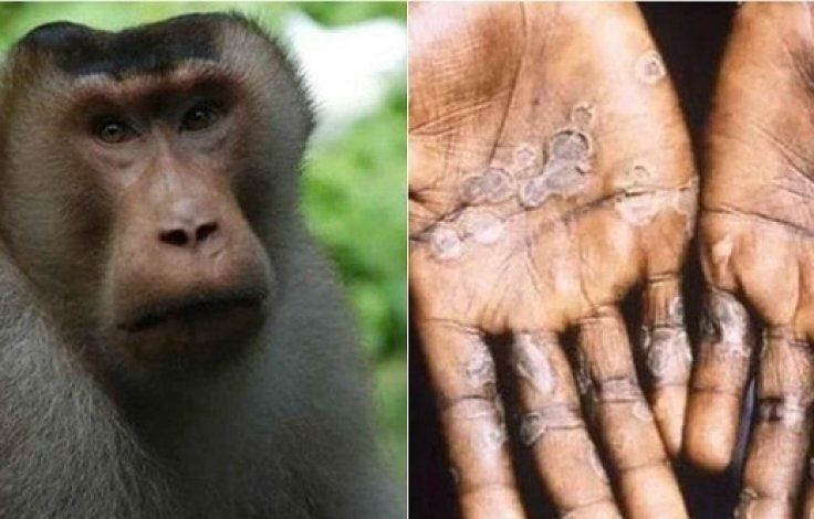 ��� �������� ��� ����������� ���������� ������ � ������� ���� ��� ����������� ���� �������