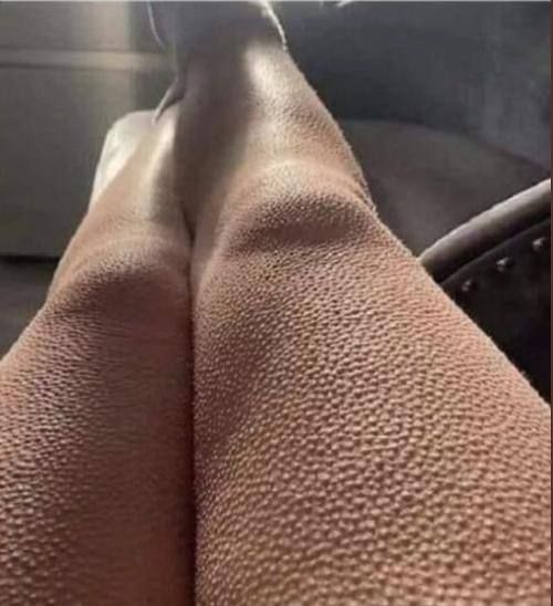 ��� �����. ������ ������� ���������