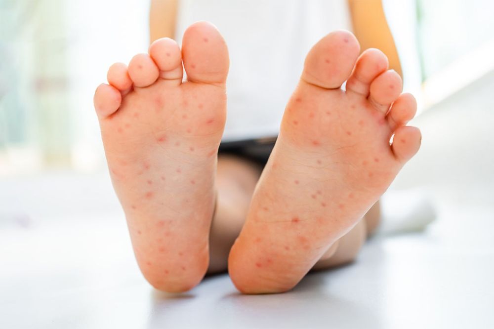 � ���������� ������� ����� ���������������� ����� �������