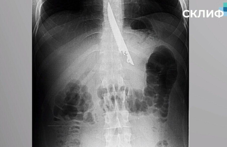 ��������� �������� ��������� ���, ����� �������� ������