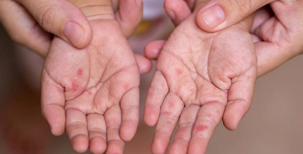 � ���� ���� � ������� ���������������� 210 ������� ����