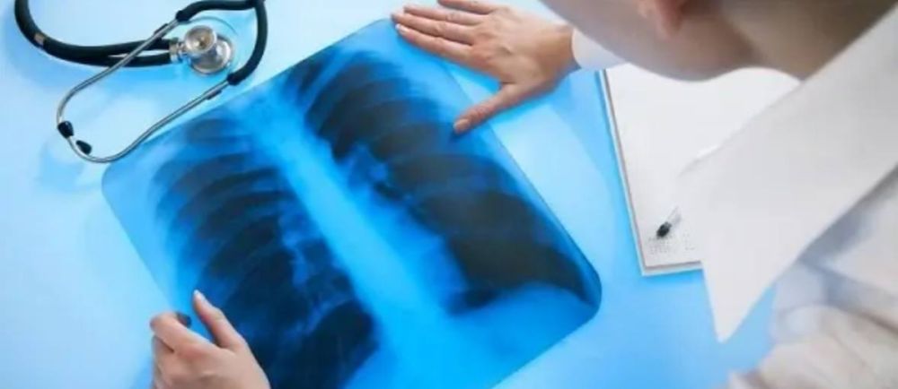 � ������������� ����� ���� ������ �����������