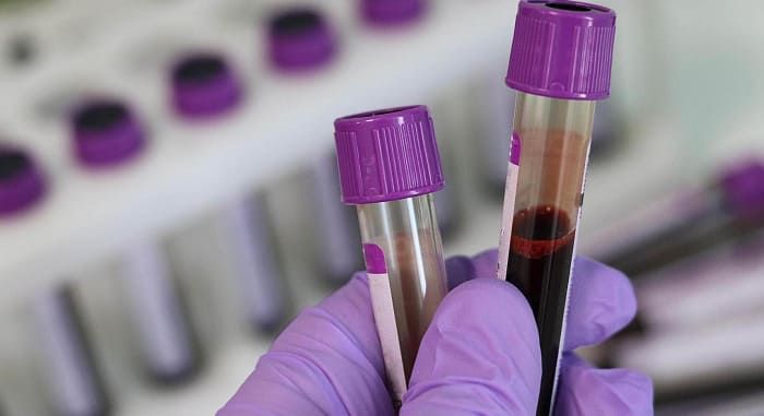 ������ � ��������������� ������� ����� ��������� ��������� �� �����������, ������������ ������� �����