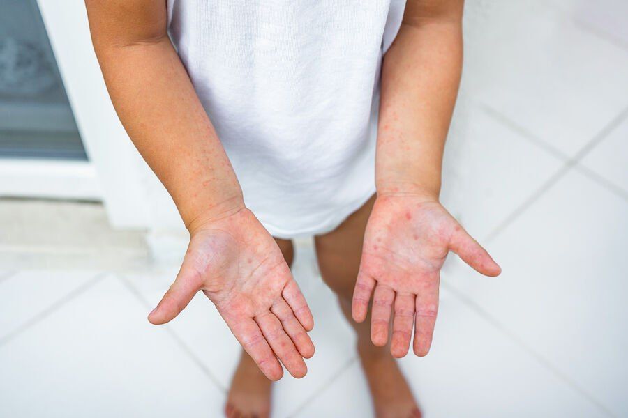 � ������� � ����� �Starlight Resort� ������� ������ ������� ����� ���������� �������� � �������� 15 �������, ������� �����