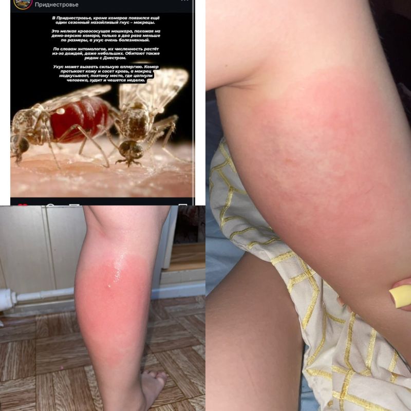 ���������� ������� ��������� �� ���� �������