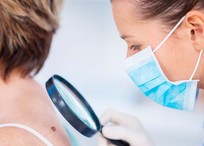 Профилактический осмотр на злокачественные новообразования кожи