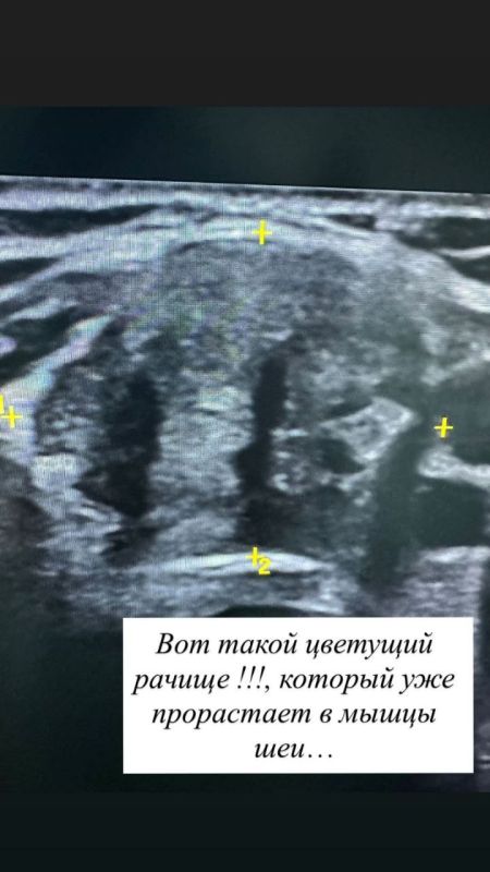 ������������ ������ �������� ���������, ��� ��� ��������� ���������� ���� ��� ���������� ������, ����� �������� � ���������� �� ����������