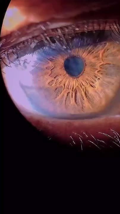 Так выглядят наши глаза, при увеличении в тысячу раз