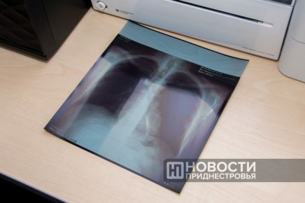 В Тирасполе 15% детей — более 3,8 тысячи — не прошли пробу Манту из-за отказов родителей