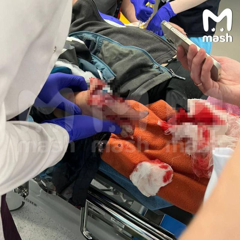 Мальчику оторвало пальцы — он попытался поднять сверток денег рядом с детской площадкой, после произошёл взрыв