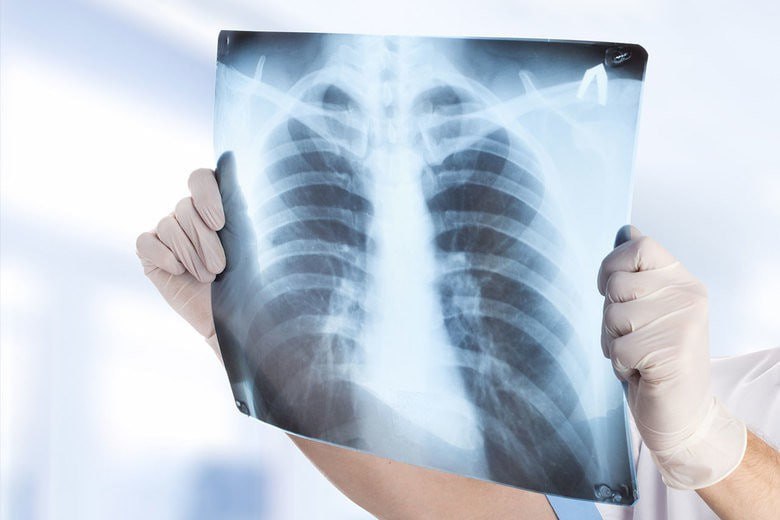 Выездная флюорография приехала в Парканы