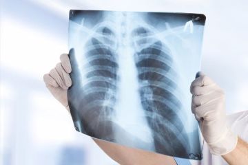 Выездная флюорография приехала в Парканы