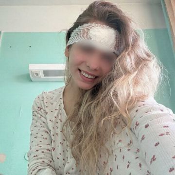 Из-за обычного прыщика россиянке разрезали лоб и положили в больницу
