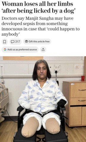 Женщине ампутировали руки и ноги после того, как её облизала собака