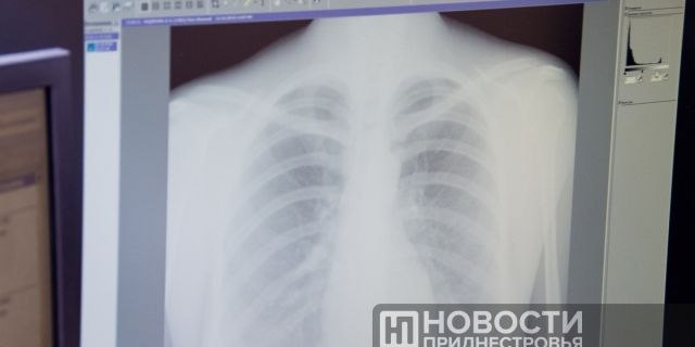 В рамках Недели профилактики инфекционных заболеваний в Бендерах организовали бесплатное флюорообследование для всех желающих