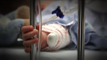 Опасность на кухне. В Бендерский центр матери и ребенка поступила двухлетняя малышка с серьезными термическими ожогами 2-3-й степени и была госпитализирована в реанимацию