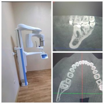� ������������� ��������� � ������ ��������� ����� �������-�������� ��� 3D-������������ �����